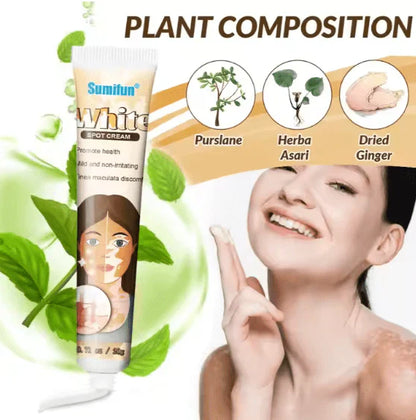 كريم علاج البهاق من Sumifun