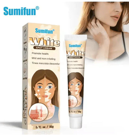 كريم علاج البهاق من Sumifun